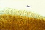 Dettaglio degli organi pluriloculari